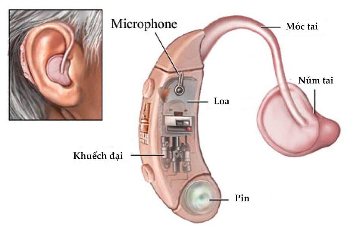 Cách sử dụng máy nghe trợ thính