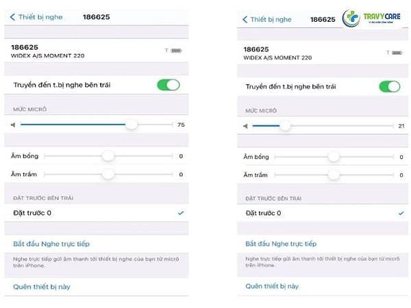Chỉnh micro trên điện thoại thông minh